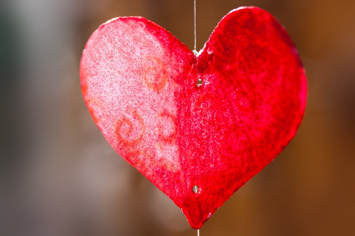 Implementing Opt-out 
					Policy to Increase Organ Donation Rate?